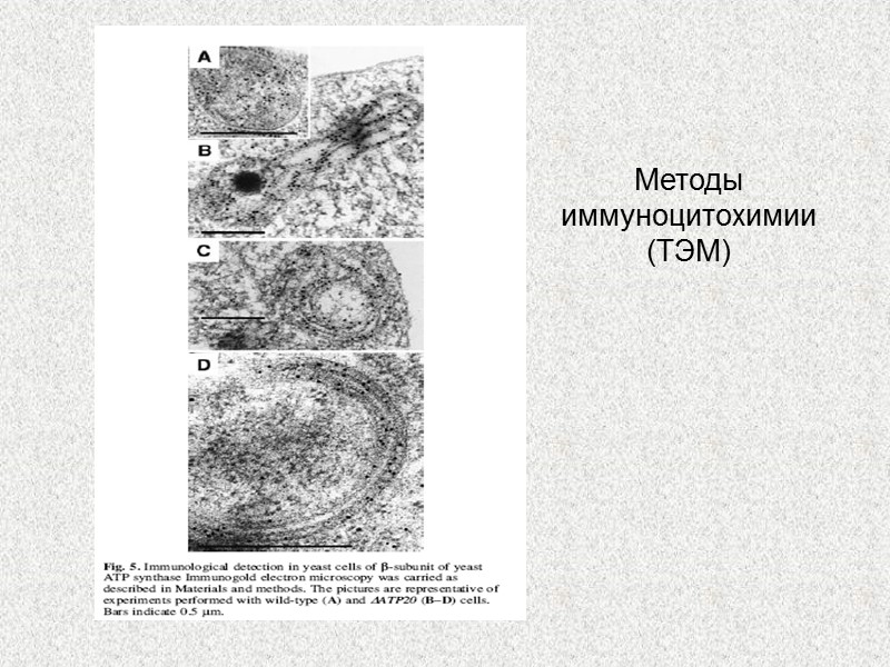 Методы иммуноцитохимии (ТЭМ)